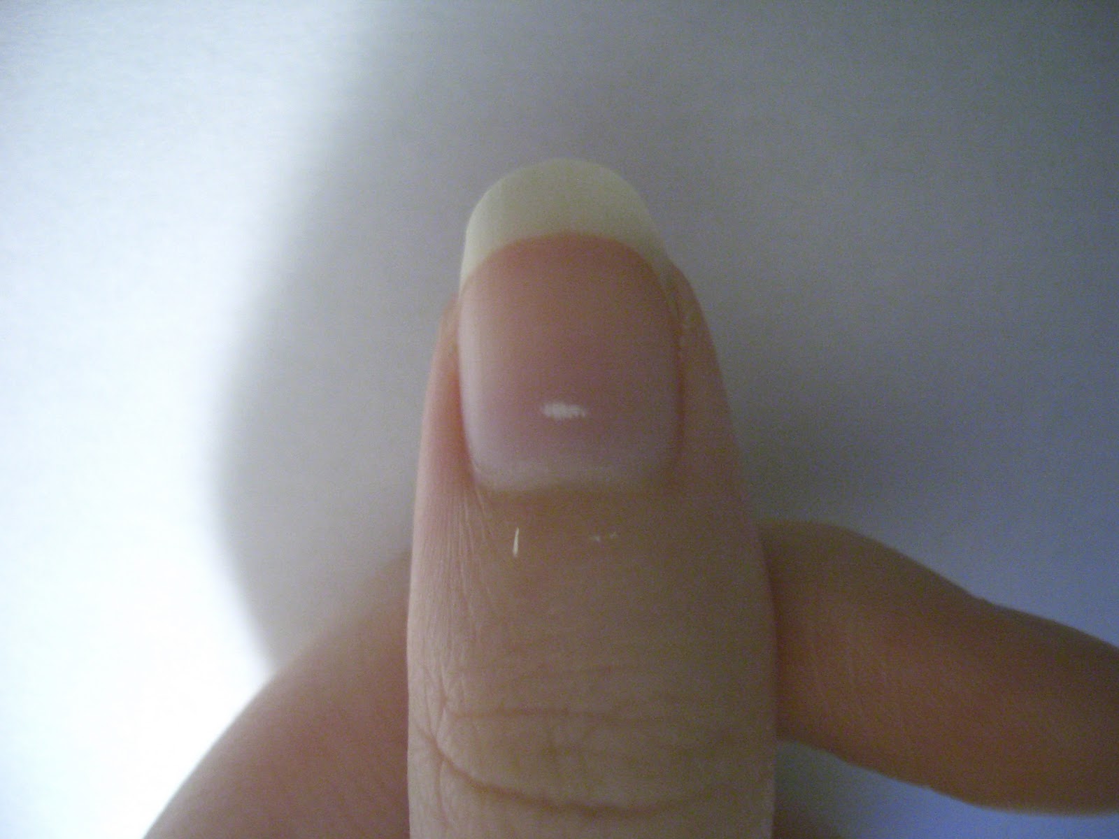 why-are-there-white-spots-on-fingernails